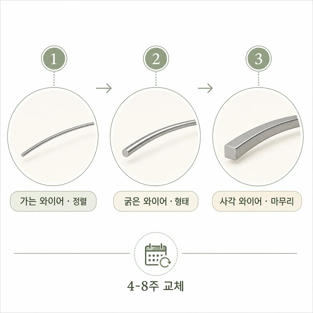 교정 와이어 두께 단계별 변화 (가는 와이어에서 굵은 사각 와이어까지)