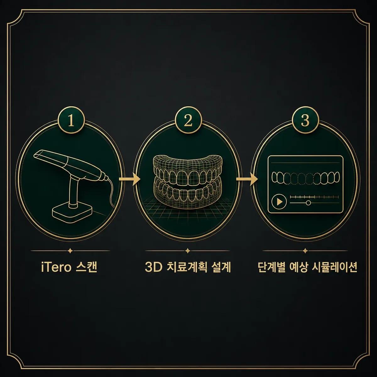 교정 와이어 두께 단계별 변화 (가는 와이어에서 굵은 사각 와이어까지)